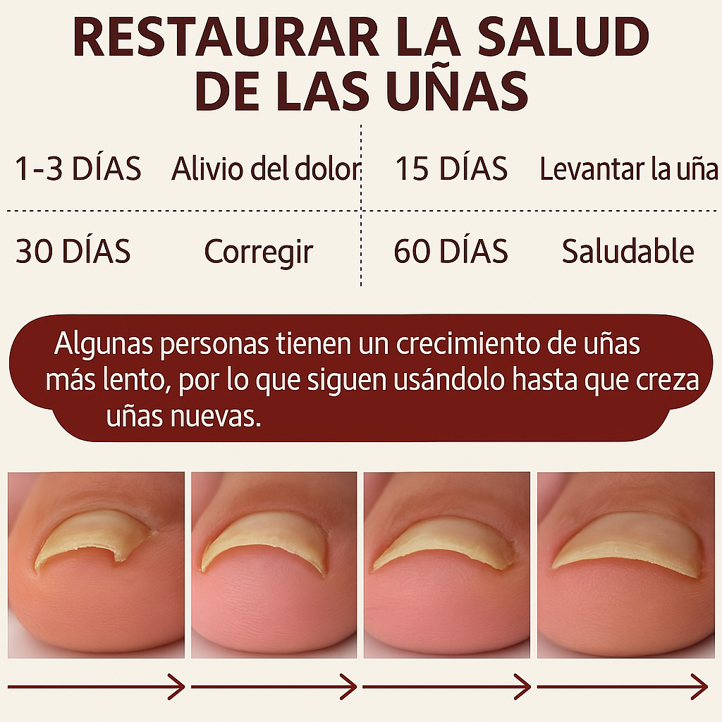 🟩 Anti Hongos Profesional  – German ToenailPlus