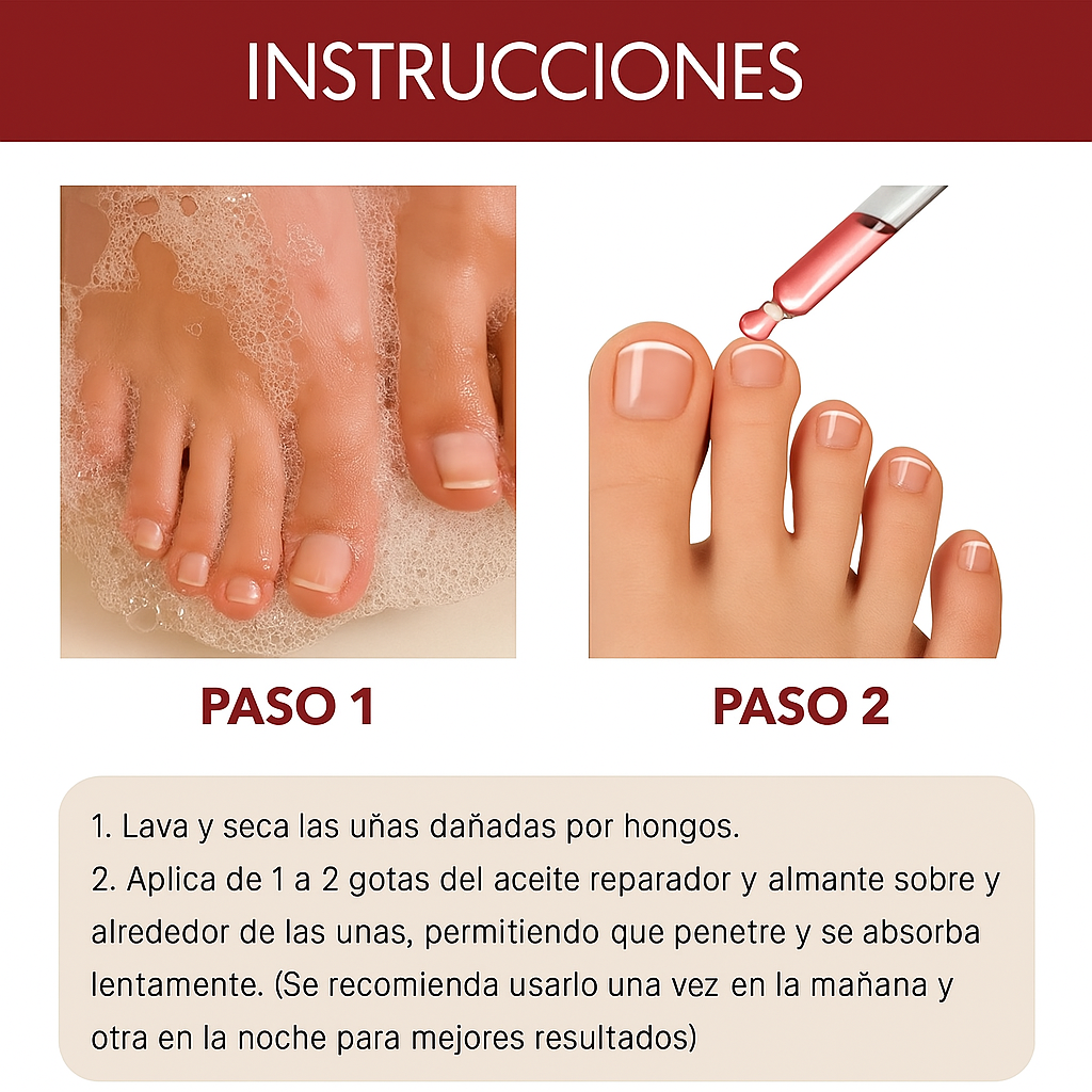 🟩 Anti Hongos Profesional  – German ToenailPlus